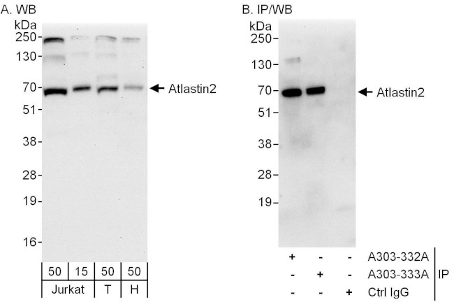 Atlastin-2 Antibody in Western Blot (WB)