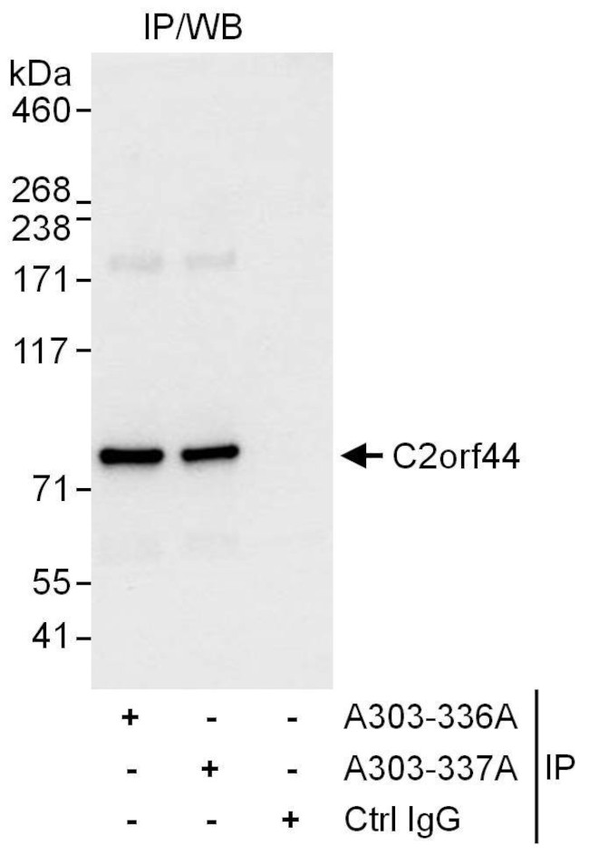 C2orf44 Antibody in Immunoprecipitation (IP)