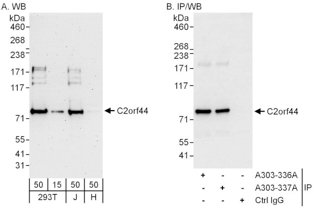 C2orf44 Antibody in Western Blot (WB)