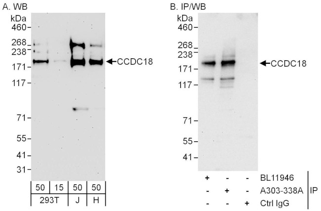 CCDC18 Antibody in Western Blot (WB)