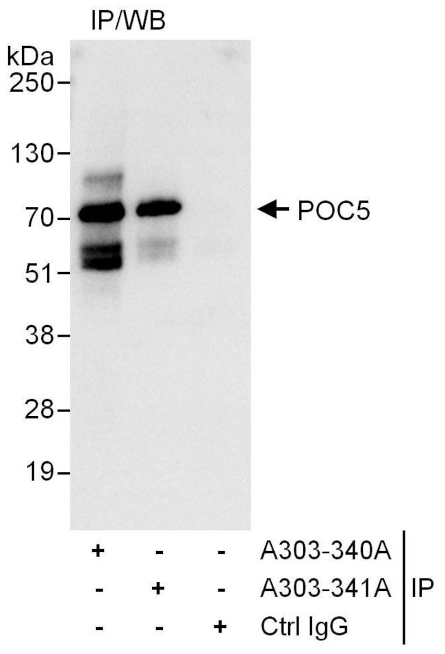 POC5 Antibody in Immunoprecipitation (IP)