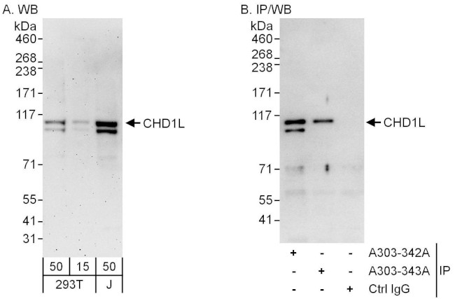 CHD1L Antibody in Western Blot (WB)