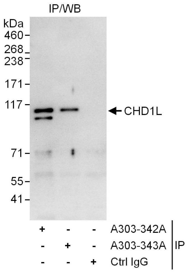 CHD1L Antibody in Immunoprecipitation (IP)