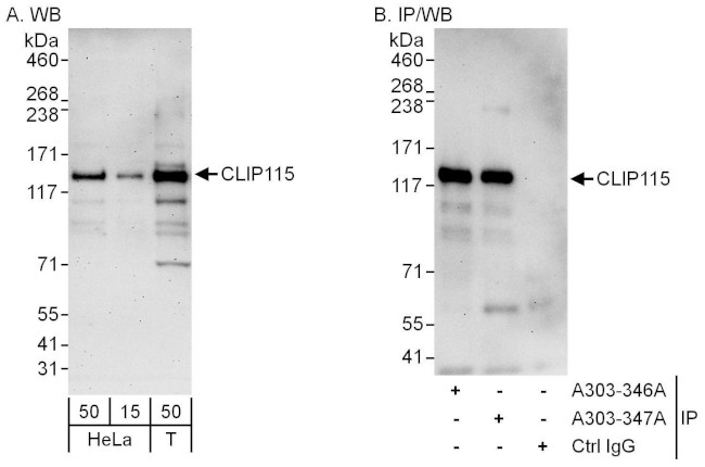CLIP115 Antibody in Western Blot (WB)