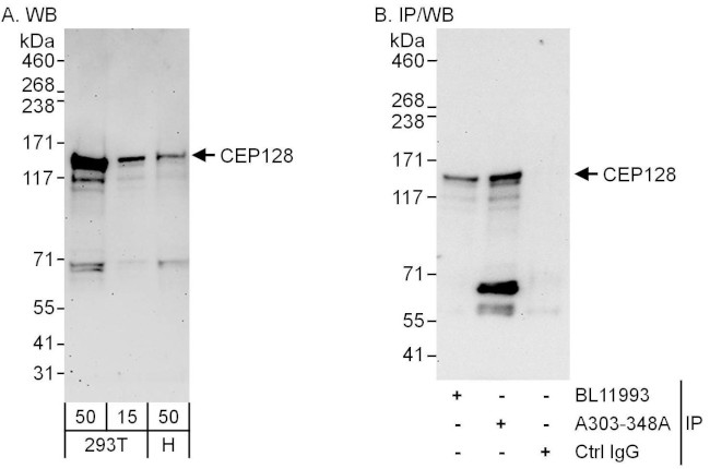 CEP128 Antibody in Western Blot (WB)