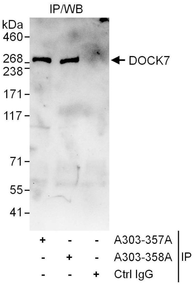 DOCK7 Antibody in Immunoprecipitation (IP)