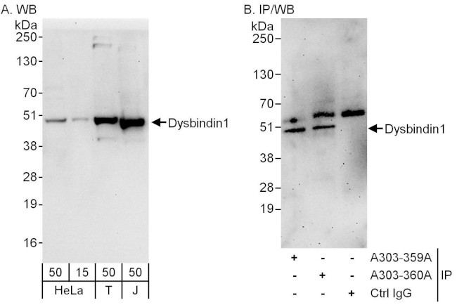 Dysbindin1 Antibody in Western Blot (WB)