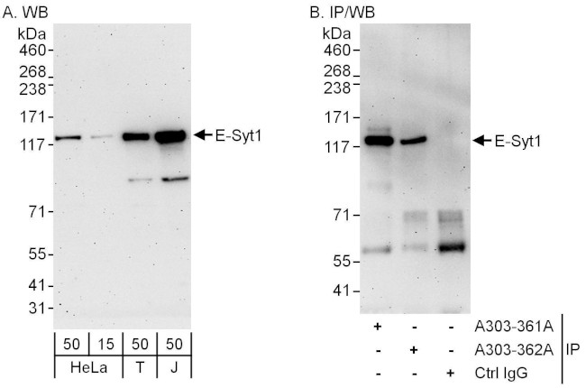 E-Syt1 Antibody in Western Blot (WB)