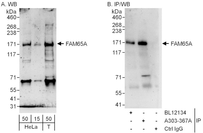 FAM65A Antibody in Western Blot (WB)