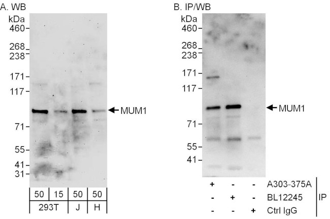 MUM1 Antibody in Western Blot (WB)