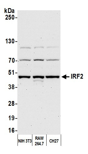 IRF2 Antibody in Western Blot (WB)
