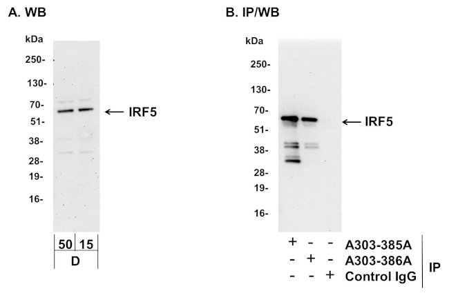IRF5 Antibody in Western Blot (WB)