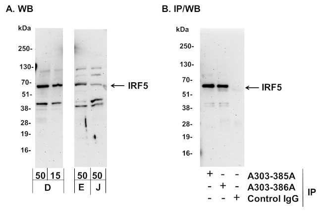 IRF5 Antibody in Western Blot (WB)