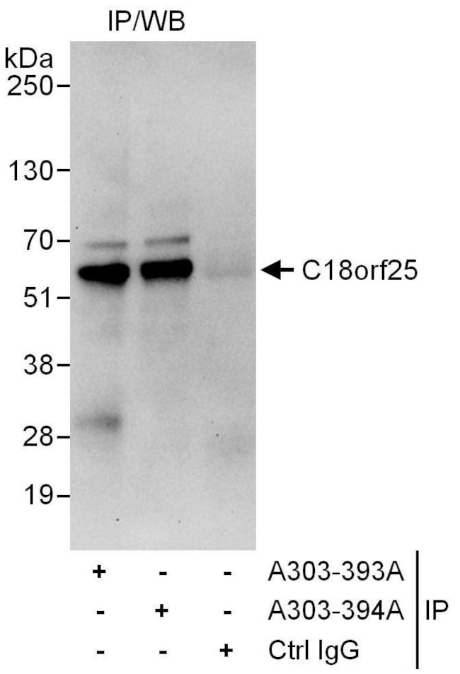 C18orf25 Antibody in Immunoprecipitation (IP)