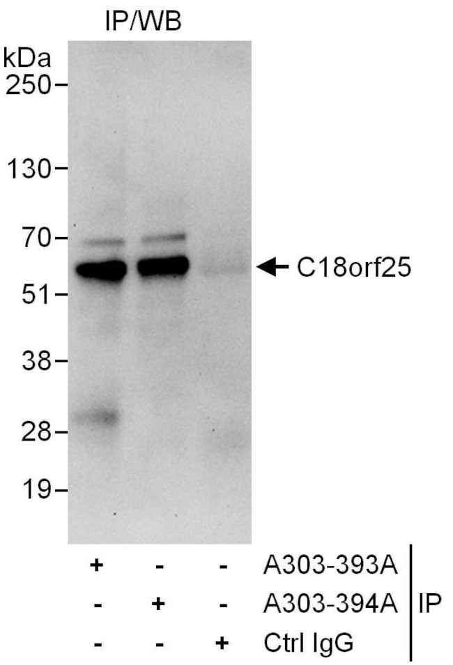 C18orf25 Antibody in Immunoprecipitation (IP)
