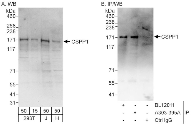 CSPP1 Antibody in Western Blot (WB)