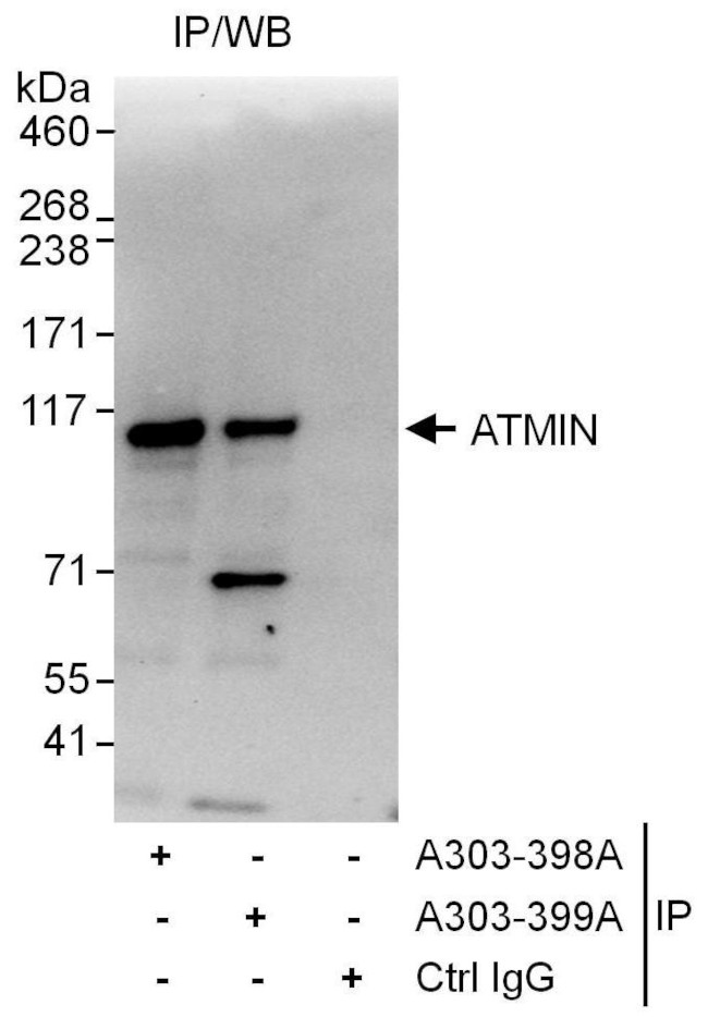 ATMIN Antibody in Immunoprecipitation (IP)