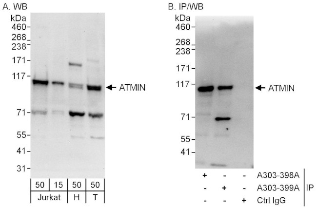 ATMIN Antibody in Western Blot (WB)