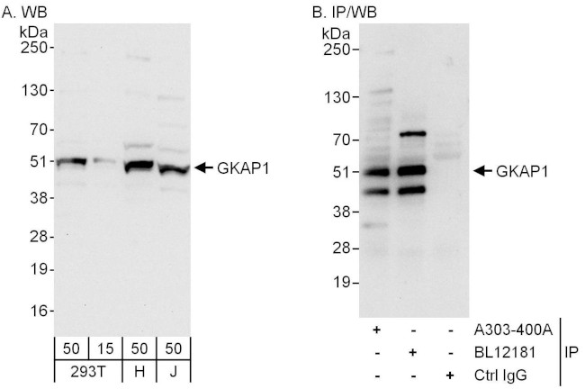GKAP1 Antibody in Western Blot (WB)