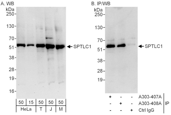 SPTLC1 Antibody in Western Blot (WB)