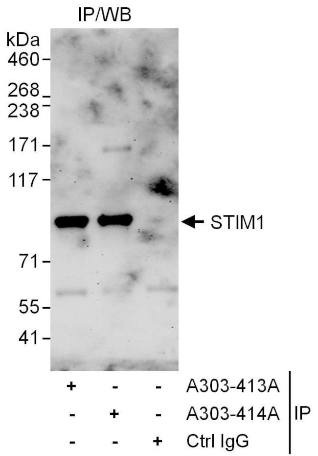 STIM1 Antibody in Immunoprecipitation (IP)
