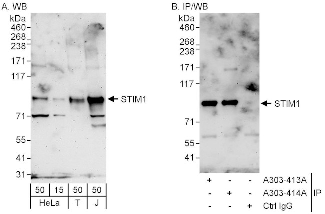 STIM1 Antibody in Western Blot (WB)