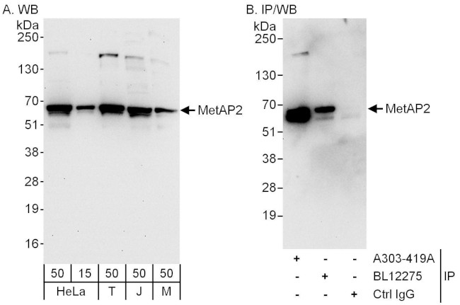 MetAP2 Antibody in Western Blot (WB)