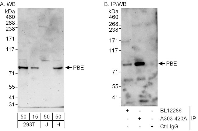 PBE Antibody in Western Blot (WB)