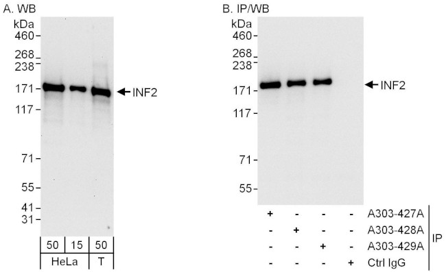 INF2 Antibody in Western Blot (WB)