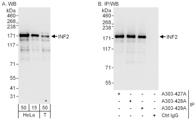 INF2 Antibody in Western Blot (WB)