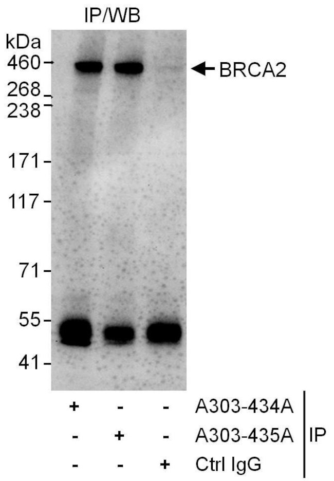 BRCA2 Antibody in Immunoprecipitation (IP)