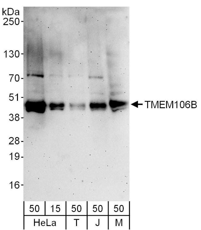 TMEM106B Antibody in Western Blot (WB)