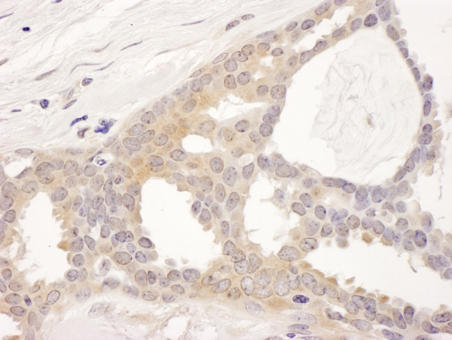 CCT8 Antibody in Immunohistochemistry (Paraffin) (IHC (P))