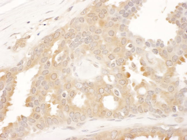 CCT8 Antibody in Immunohistochemistry (Paraffin) (IHC (P))
