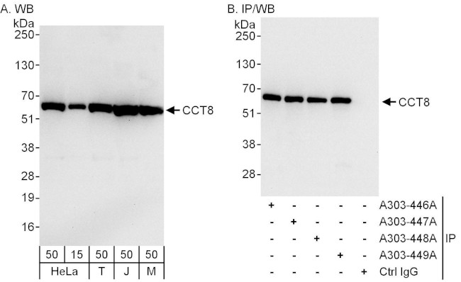 CCT8 Antibody in Western Blot (WB)