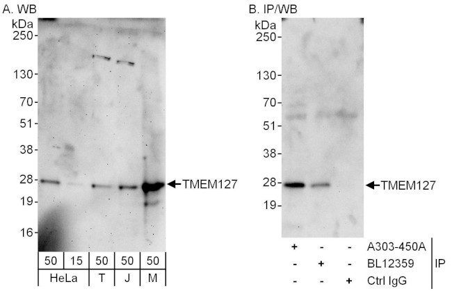 TMEM127 Antibody in Western Blot (WB)