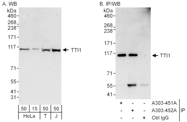 TTI1 Antibody in Western Blot (WB)