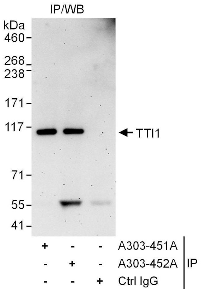 TTI1 Antibody in Immunoprecipitation (IP)