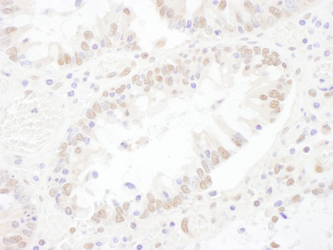 SNRNP200 Antibody in Immunohistochemistry (Paraffin) (IHC (P))