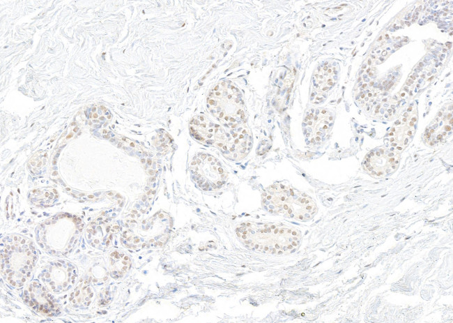 SNRNP200 Antibody in Immunohistochemistry (Paraffin) (IHC (P))