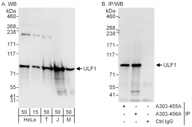 UFL1 Antibody in Western Blot (WB)