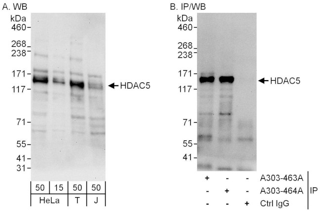 HDAC5 Antibody in Western Blot (WB)