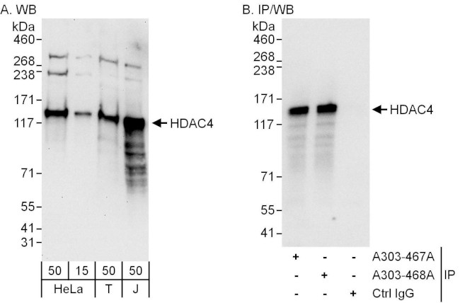 HDAC4 Antibody in Western Blot (WB)