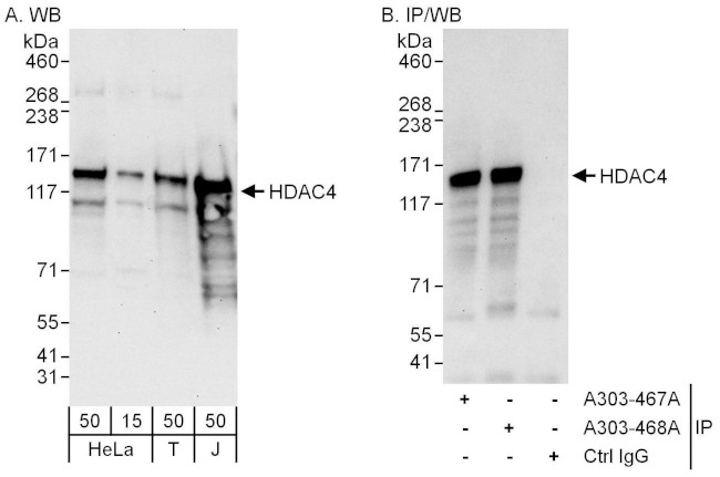 HDAC4 Antibody in Western Blot (WB)