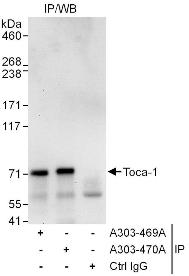 Toca-1 Antibody in Immunoprecipitation (IP)
