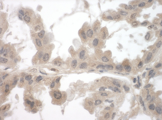 Toca-1 Antibody in Immunohistochemistry (Paraffin) (IHC (P))