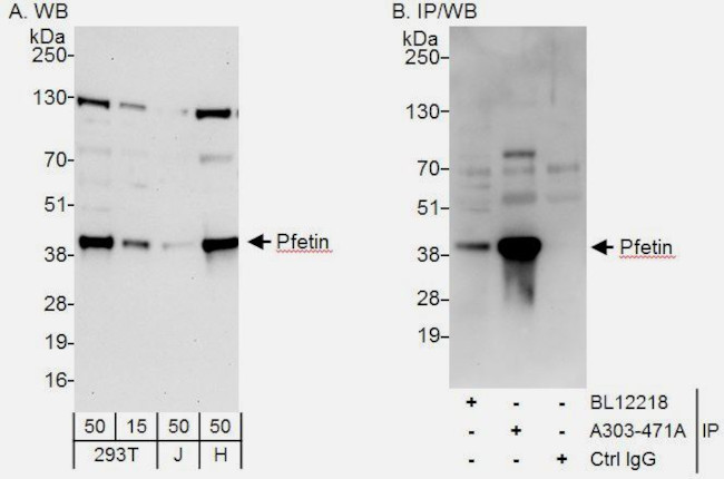 Pfetin Antibody in Western Blot (WB)