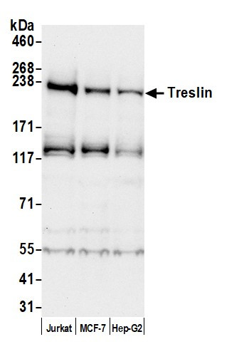 Treslin Antibody in Western Blot (WB)