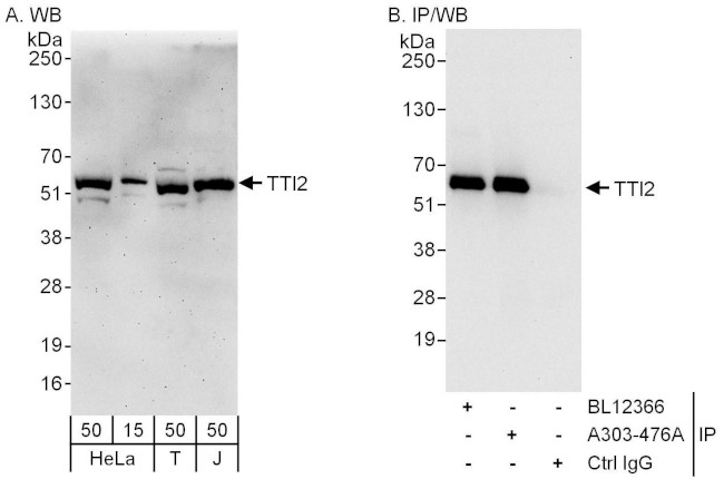 TTI2 Antibody in Western Blot (WB)