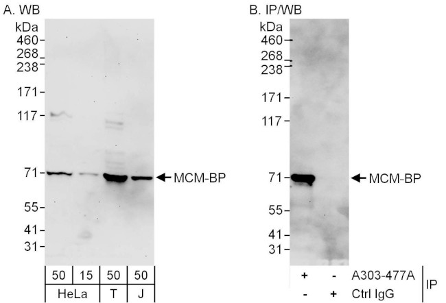MCM-BP Antibody in Western Blot (WB)